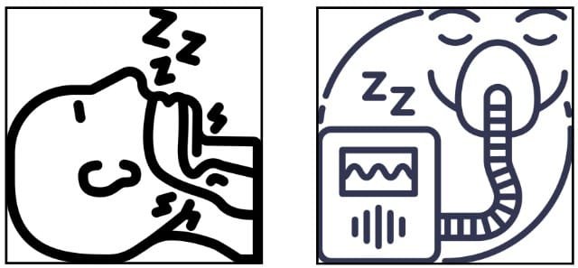 apnea graphics